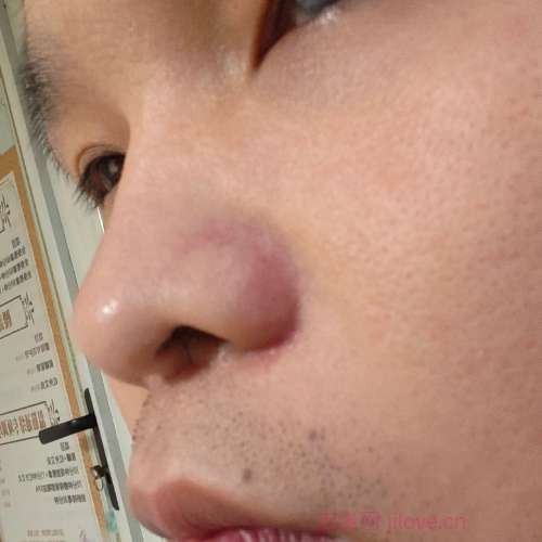30岁岁江苏单身帅哥 - 大兴安岭吉缘网